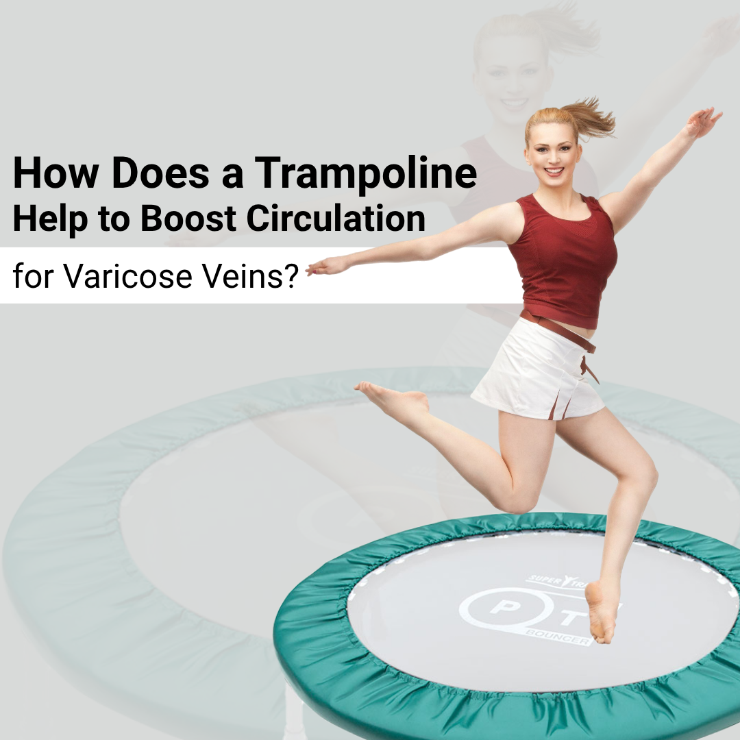 How Does Rebounding Help Boost Circulation for Varicose Veins