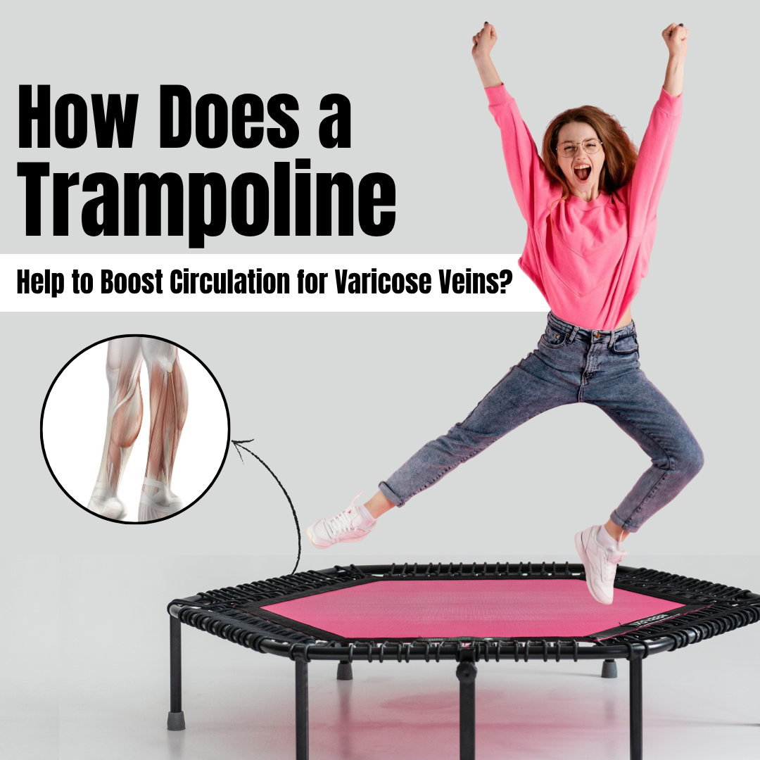 trampoline for varicose veins circulation