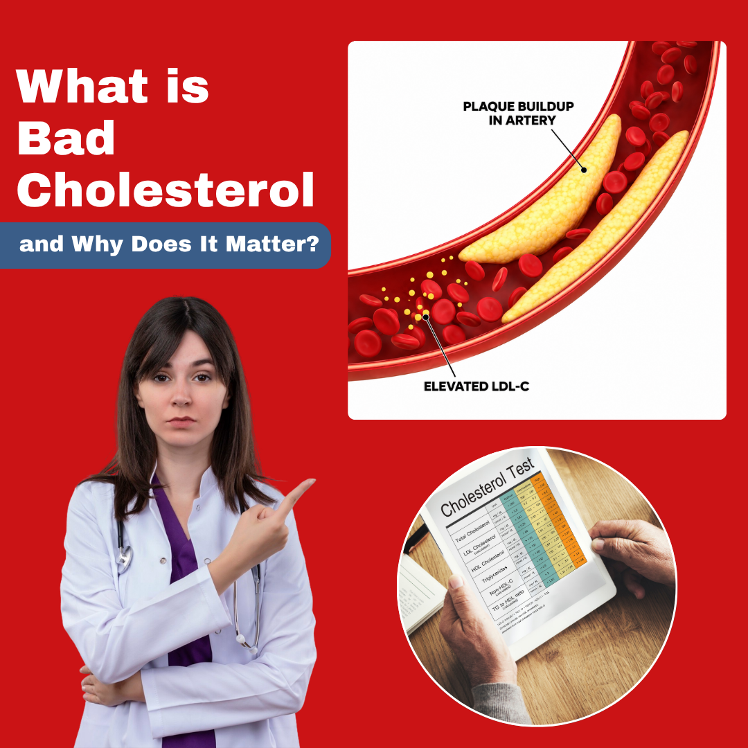 What is Bad Cholesterol and Why Does It Matter